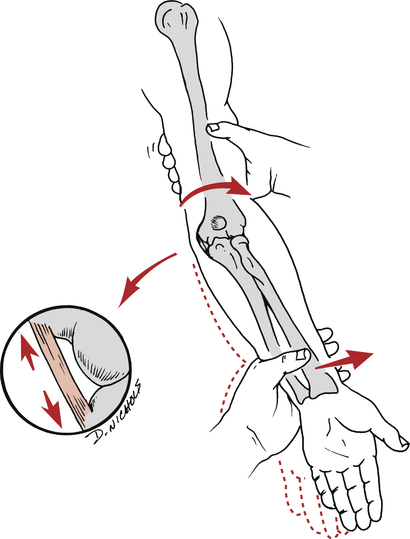 Pitcher’s Elbow: How Valgus Force Puts You at Risk
